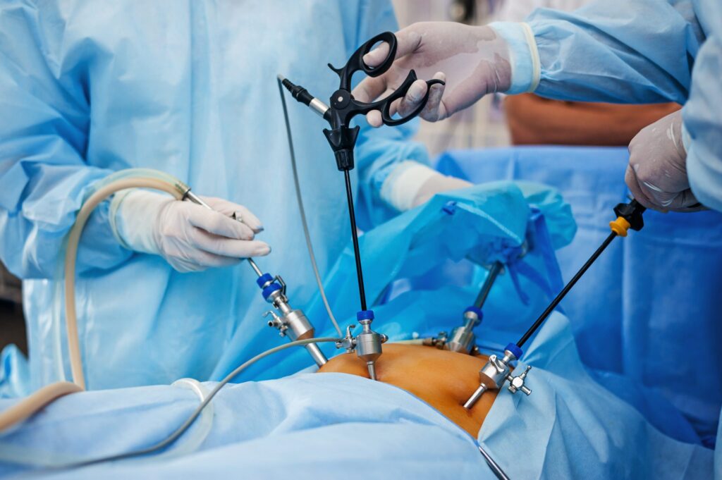 Laparoscopic surgery